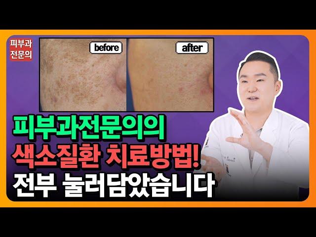 색소질환에 대한 궁금증 및 내게 맞는 레이저 알려드립니다! ｜실제 시술영상｜치료방법