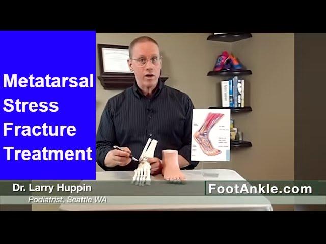 Metatarsal Stress Fractures - How to Diagnose Yourself