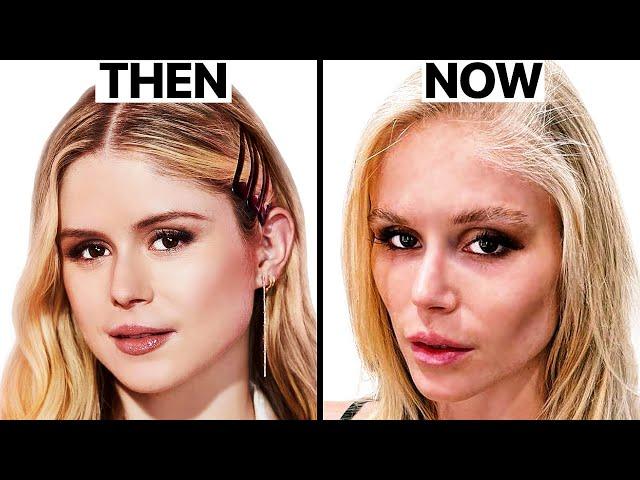 Erin Moriarty (The Boys) NEW FACE | Plastic Surgery Analysis