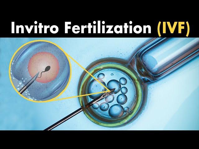 What is InVitro Fertilization? |  (IVF)