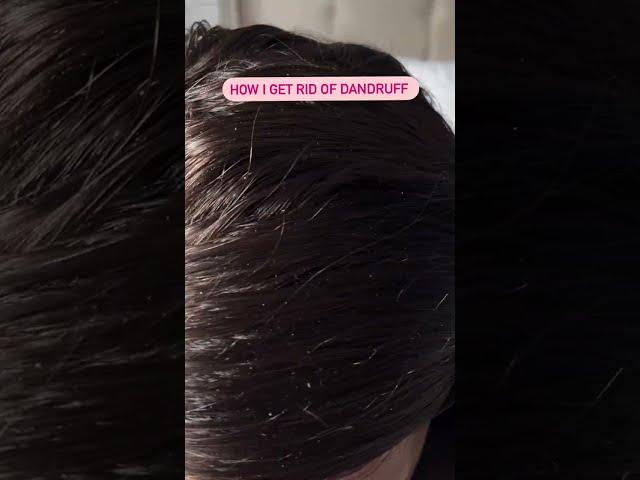 How I get rid of dandruff using a scalp massage brush