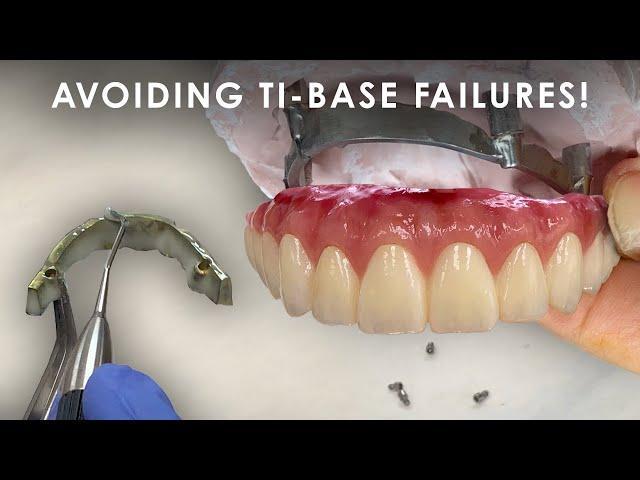 How to Avoid Ti-Base Failures