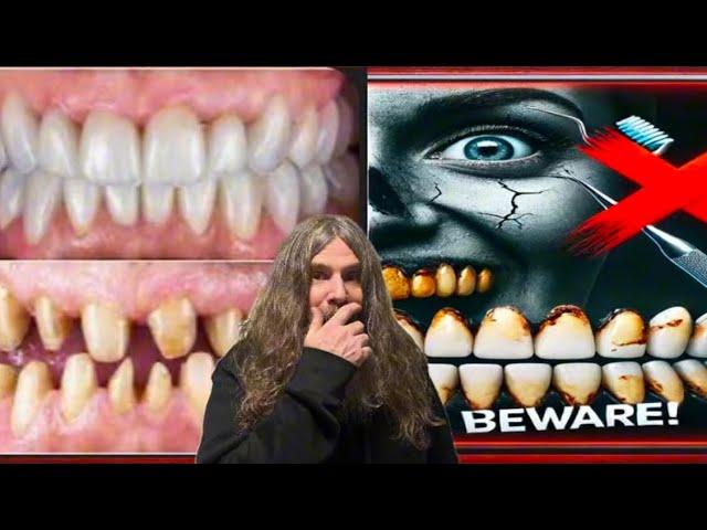 "Exposing Veneer Tech Scams: The Hidden Dangers of Fake Dental Work" Blagg Tv REACTS￼