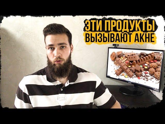 Прыщи от сладкого? АКНЕ питание / Диета от прыщей