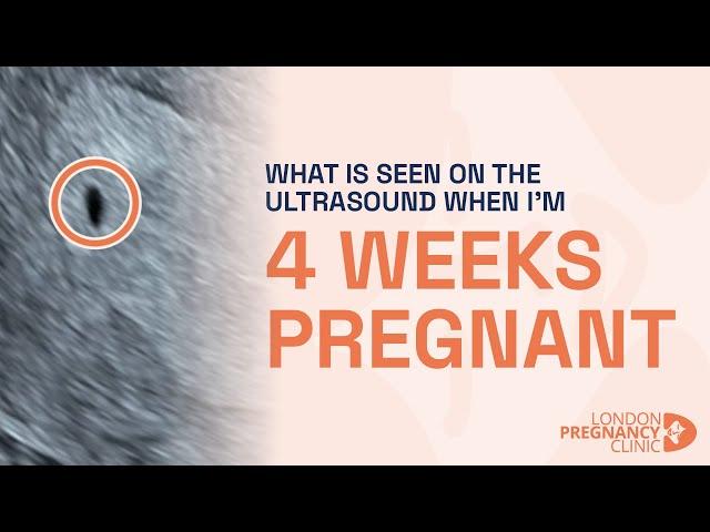 What does the 4 Week Pregnancy Scan look like? A London Pregnancy Clinic case study