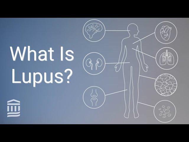 Understanding Lupus: Causes, Symptoms, Treatment, and Flare Ups | Mass General Brigham