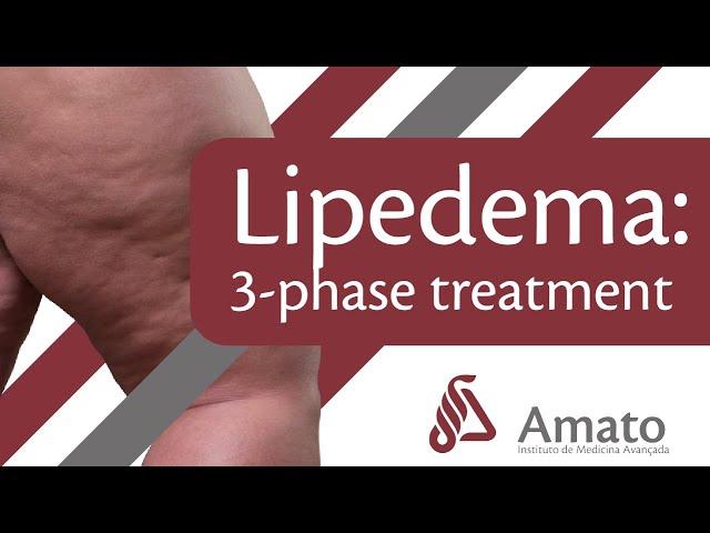 Lipedema Disease: three-phase treatment (English subs)