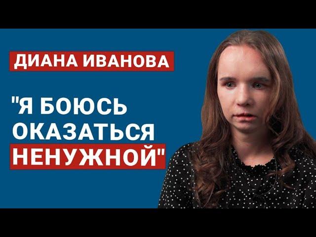 ДИАНА ИВАНОВА. ЧТО ИЗМЕНИЛОСЬ? Год после пластики. Хирургия, которая дарит новую жизнь