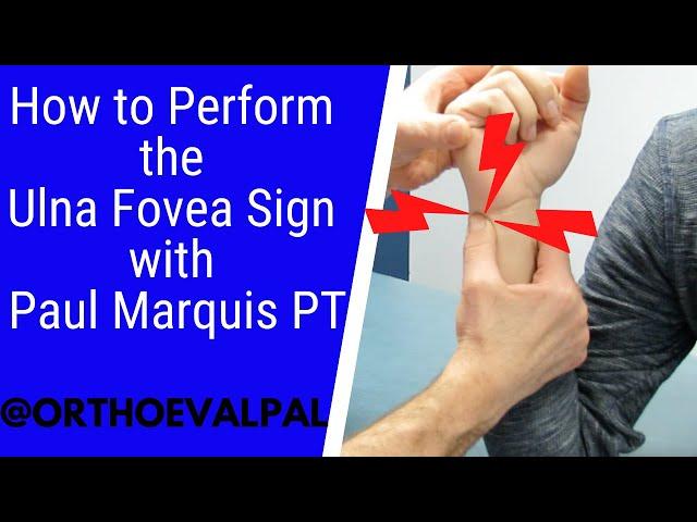 How to Perform the Ulna Fovea Sign with Paul Marquis PT