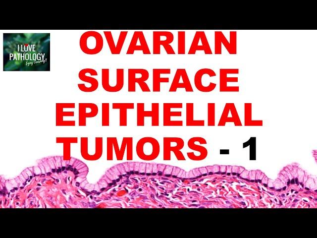 OVARIAN TUMORS -  Part 2 : SEROUS AND MUCINOUS TUMORS- Etiopathogenesis and morphology