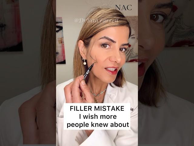 #overfilled #fillers #puffyface ##dermalfillers #fillertraining #drbitafarrell