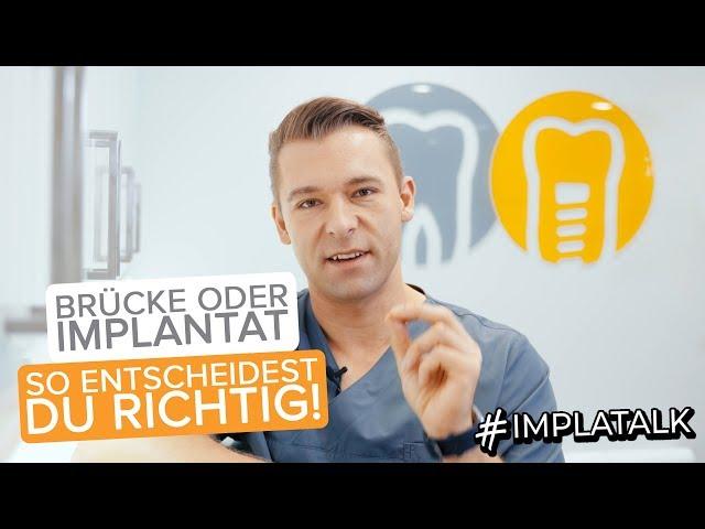 Brücke oder Implantat? So entscheidest du richtig! Implatalk EP 16