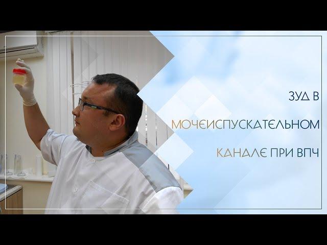 ▶ Зуд в мочеиспускательном канале при ВПЧ. Клинический случай №83