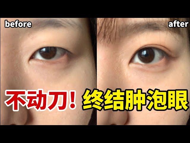 【sub】3 minute reduceds  eyelids swelling by Japanese  massage