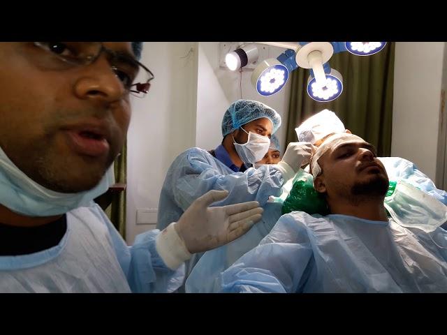 Hair Transplant Bhopal India l Real review of surgery l Painless experience