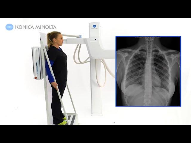 Advanced U-arm System, Dynamic Digital Radiography (DDR) | Konica Minolta Healthcare