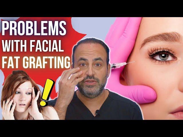 Problems with Facial Fat Grafting | Dr. Ben Talei | Beverly Hills Plastic Surgeon