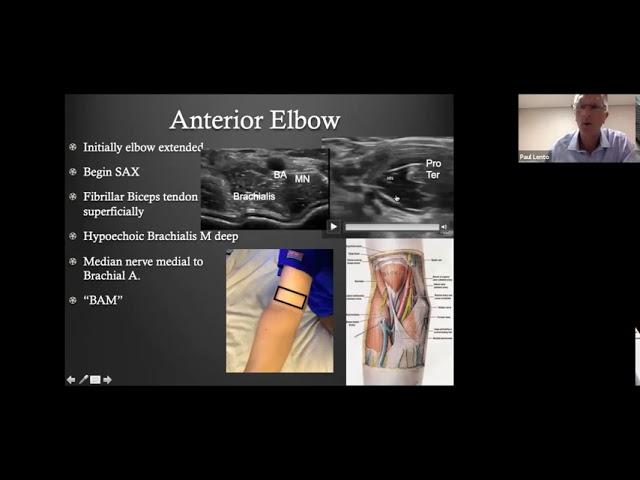 Dr. Paul Lento talks about Diagnostic/Dynamic MSK Ultrasound of Elbow