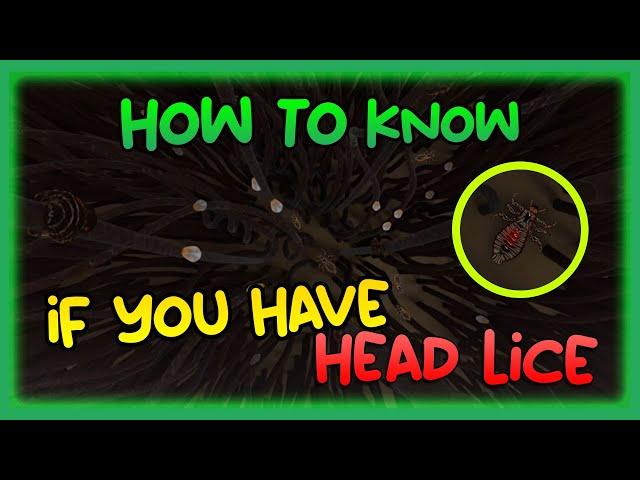 How to know if you have Head Lice #shorts #naturalhair #haircaretips #headlice #haircare