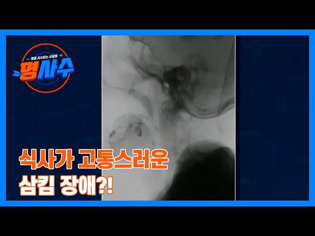 식사가 고통스러운 삼킴 장애?! 불안한 식사 시간… MBN 230712 방송