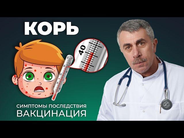 Корь: симптомы, последствия, вакцинация