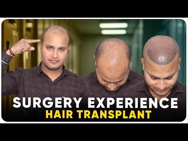 Hair Transplant in India | Best Results & Cost of Hair Transplant in India