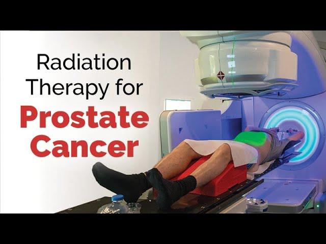 Radiation Therapy for Prostate Cancer