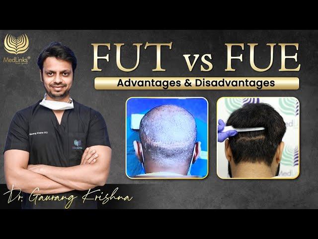 FUT vs FUE | Advantages and Disadvantages of FUT Hair Transplant over FUE Hair Transplant Technique
