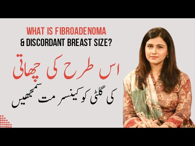 What is Fibroadenoma & Discordant Breast Size? Dr Maryam Raana Gynaecologist