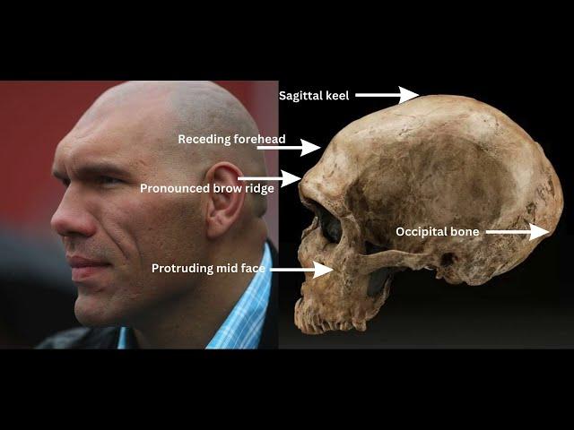 6 Neanderthal DNA physical traits in modern humans