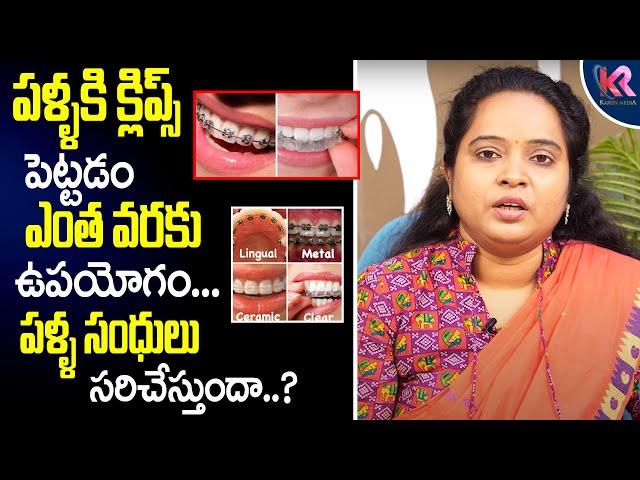 Dental Braces | Teeth Braces | Orthodontic Treatment | Dental Treatment | Karun Media Health & Homeo