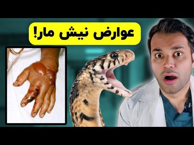 عوارض نیش مار چیه؟| ماجرای بیماری که مار شاخ دار نیشش زده بود