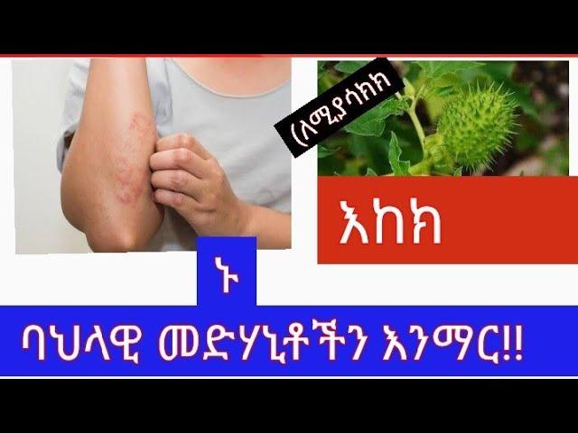 #103 ለእከክ-ፍቱን ባህላዊ መድሃኒት!! ሰውነት ለይ ለሚወጣ ሽፍታ (@ethiotube3882