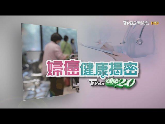 女性健康殺手【婦癌健康揭密】特別報導