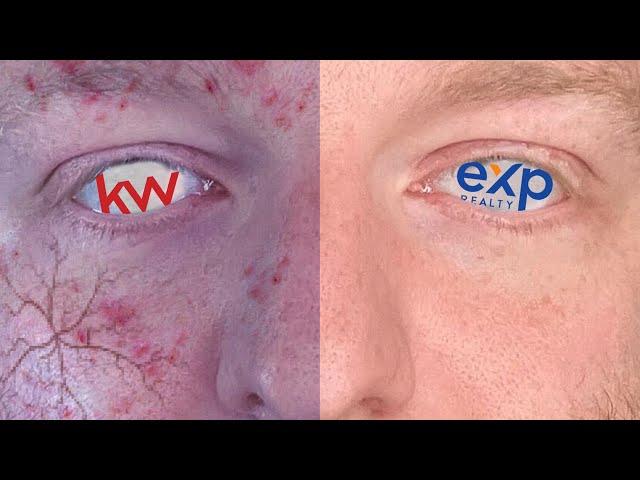 EXP Vs Keller Williams 2022 | eXp Realty Vs KW 2022