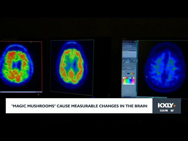 "Magic mushrooms" cause measurable changes in the brain