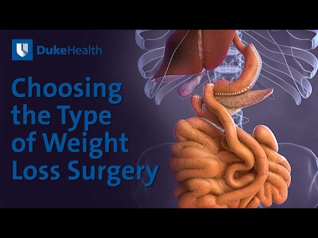 Choosing the Type of Weight Loss Surgery | Duke Health