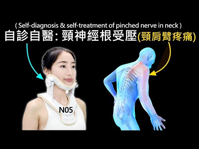 自診自醫 : 頸神經根受壓(頸肩臂疼痛) Self-diagnosis & self-treatment of pinched nerve in neck (3d 動畫) (N05)