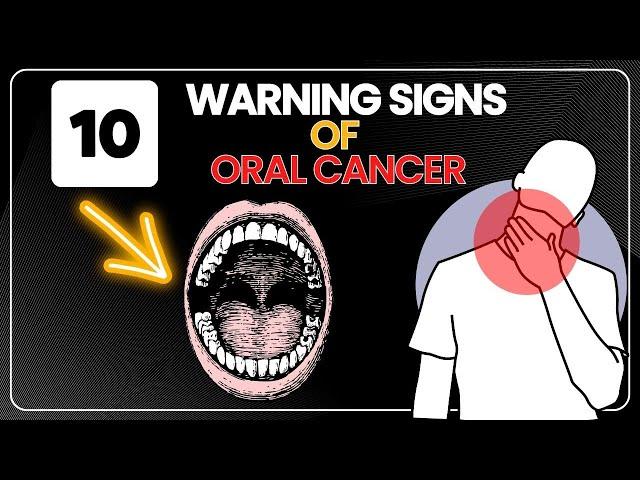 10 Warning Signs of Oral Cancer - Symptoms of Oral Cancer