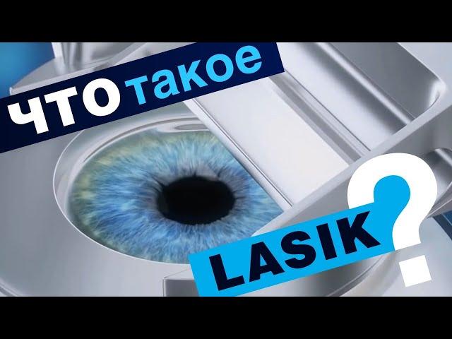 Что такое LASIK? Лазерная коррекция зрения LASIK