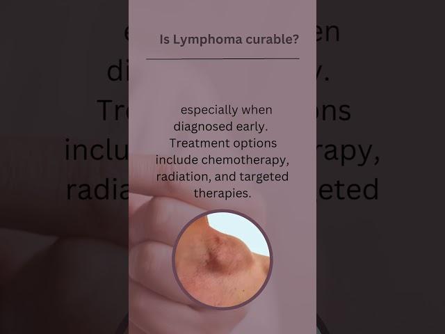 Lymphoma FAQs