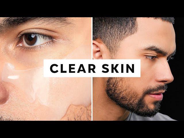 How To Get Clear Skin (Only 3 Steps)