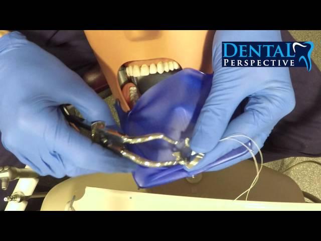 One Minute Dental Rubber dam [Dental Perspective]