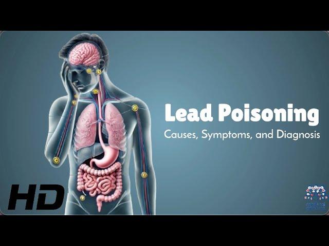 Lead Poisoning Symptoms You Can’t Ignore – Protect Your Health!