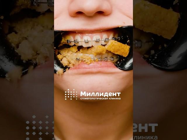 Что можно есть с брекетами? #брекеты #установкабрекетов #сухарики #ортодонт