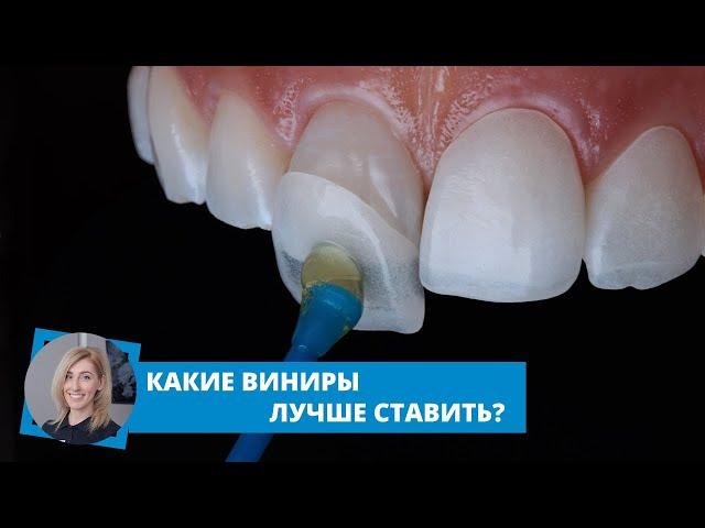 Какие виниры лучше ставить?