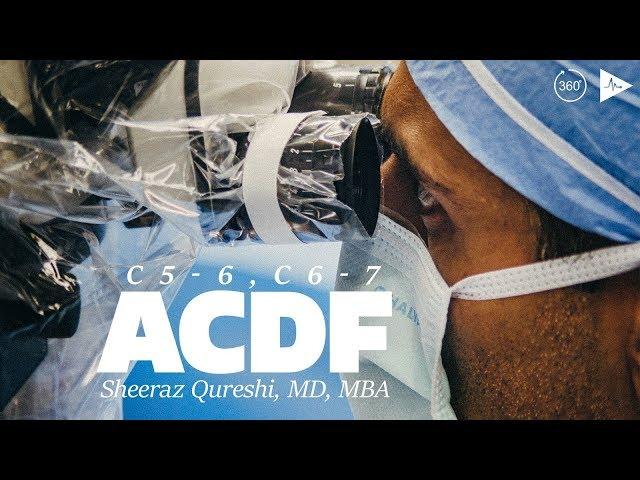 C5-6, C6-7 Anterior Cervical Discectomy and Fusion | Case Trailer