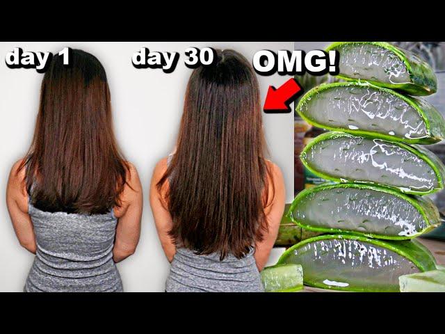 30 DAYS OF ALOE VERA FOR HAIR GROWTH BEFORE AND AFTER RESULTS