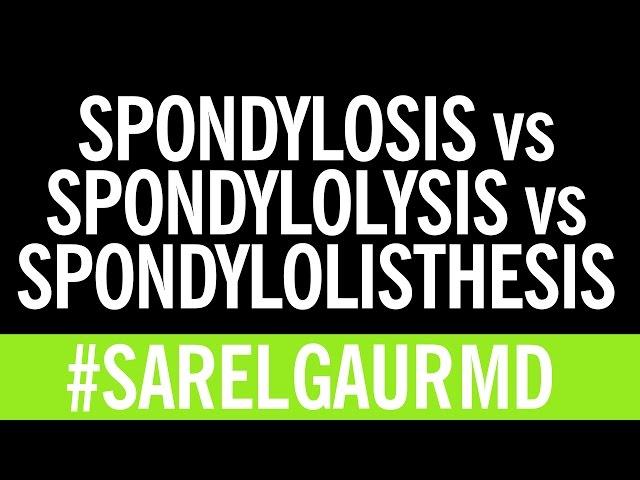 Spondylosis vs. Spondylolysis vs. Spondylolisthesis