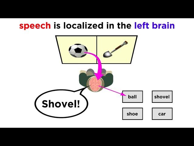 Brain Lateralization: The Split Brain